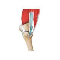 Hamstring Injuries