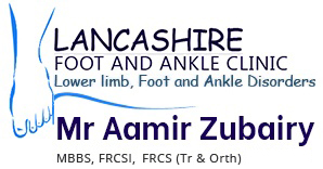 lancashire-foot-and-ankle-clinic